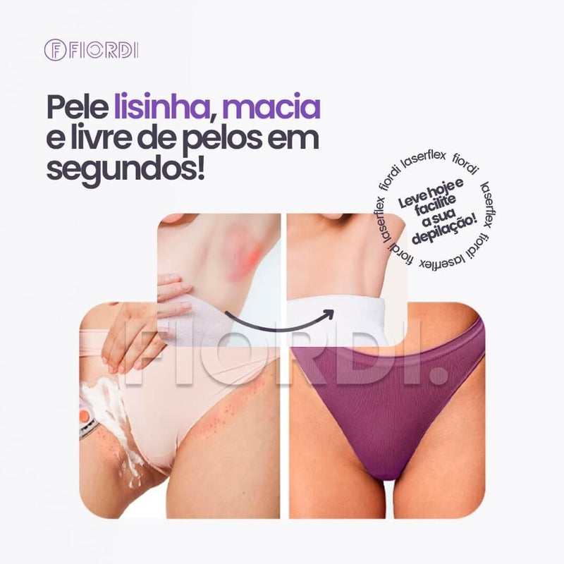 Depilador Indolor 2 em 1 - LaserFlex™ + [Brinde Exclusivo] - shopexclusiva