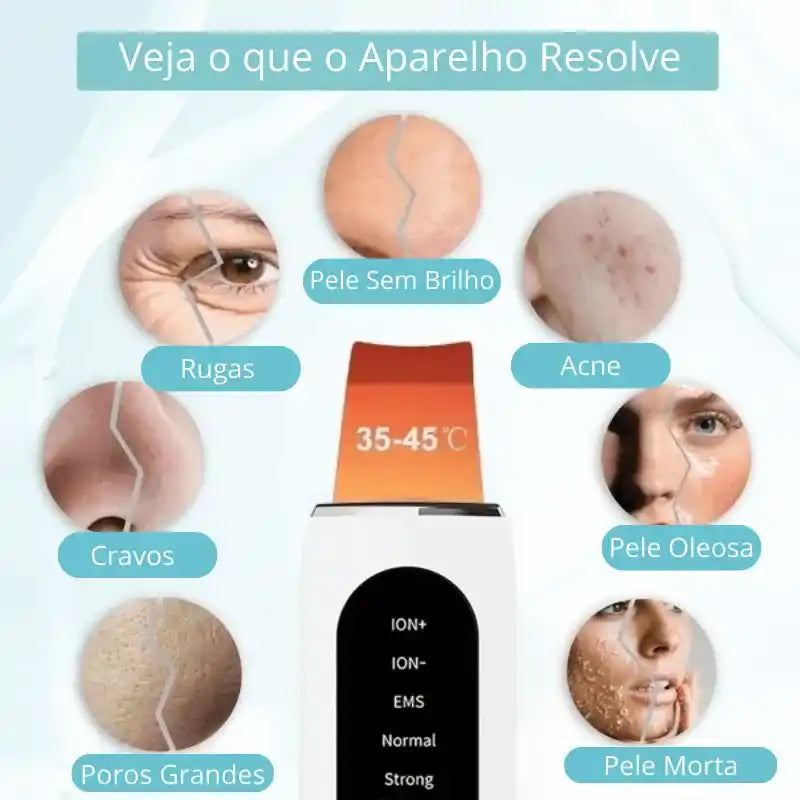 Limpeza Facial Profunda Ultrassônico 5em1