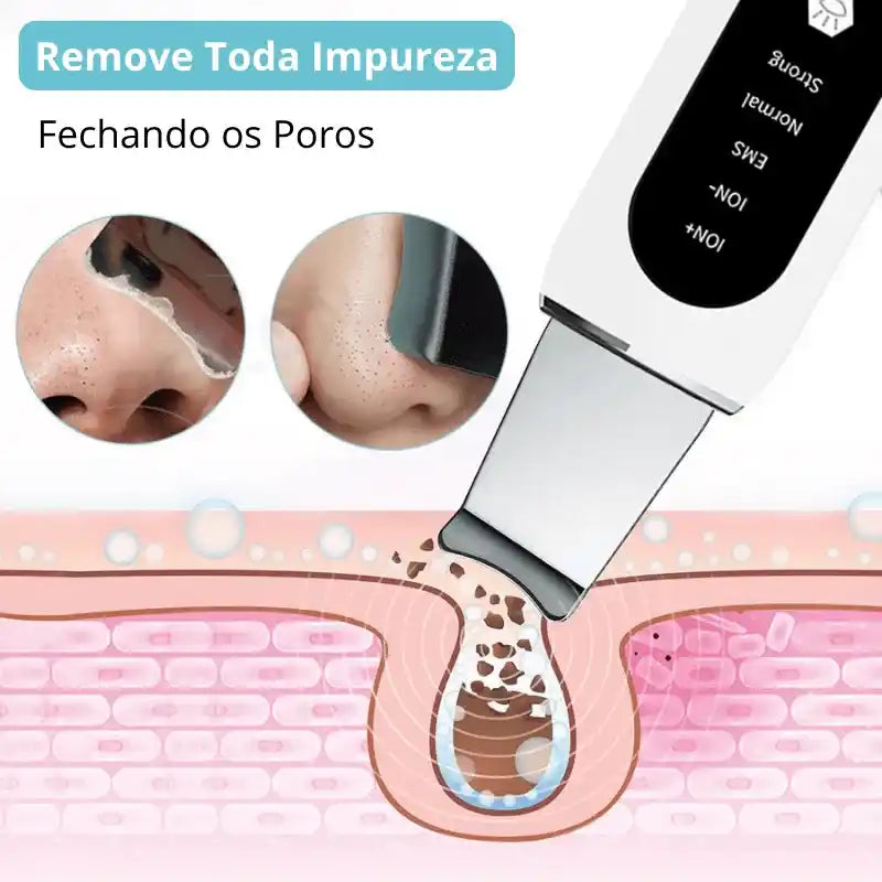 Limpeza Facial Profunda Ultrassônico 5em1